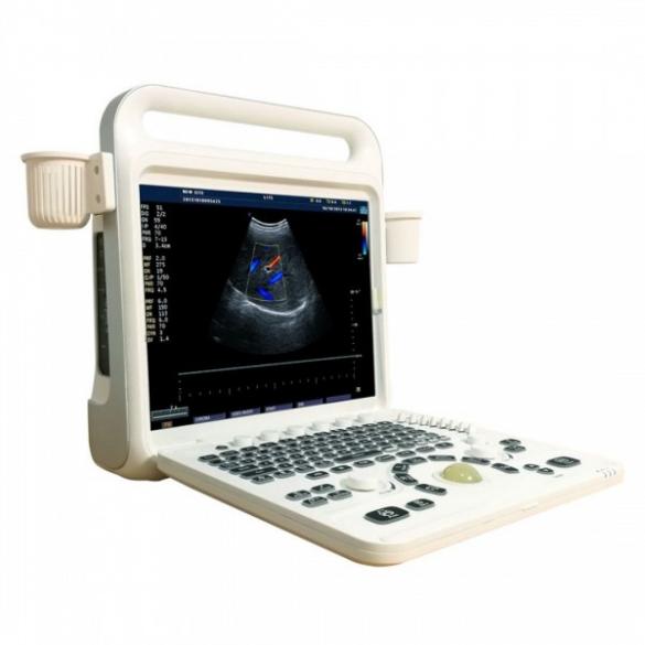 Portable Color Doppler Ultrasound System CBMCU60